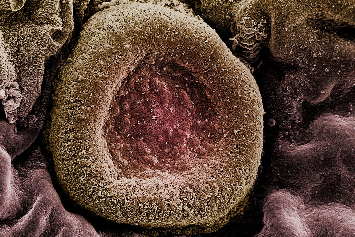La nueva vacuna se dirige a 20 serotipos de 'Streptococcus pneumoniae', causante de enfermedad neumocÃ³cica invasiva.